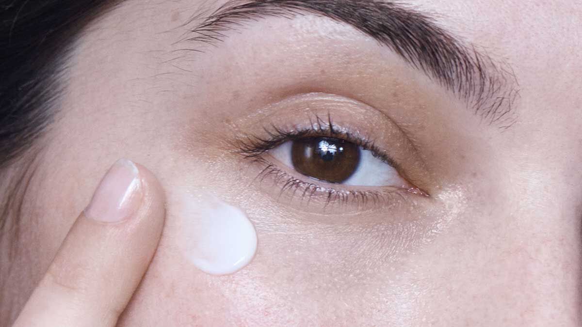 What Causes Dark Circles