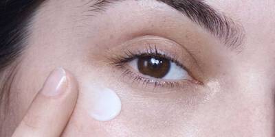 What Causes Dark Circles