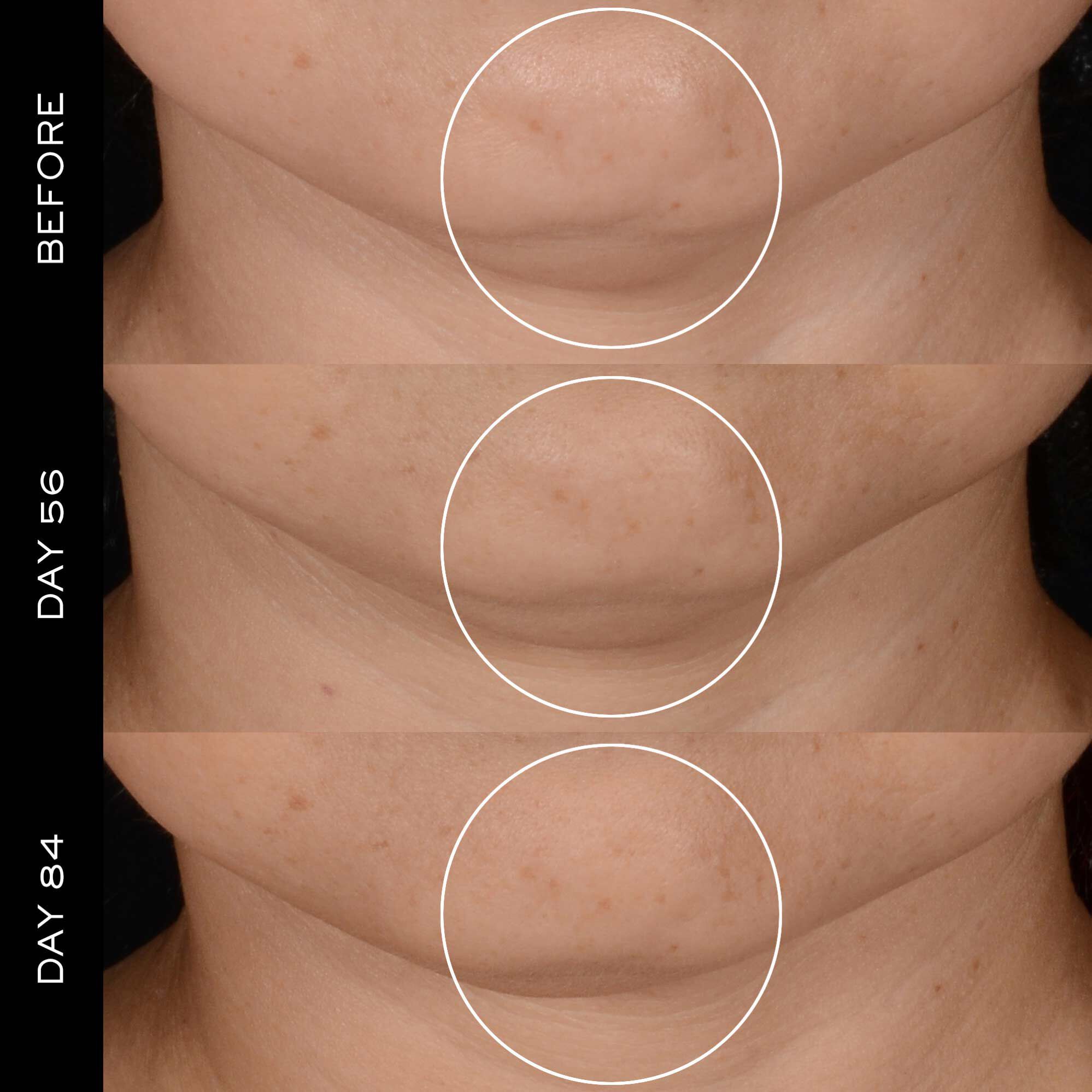 Renergie H.P.N 300-Peptide Cream